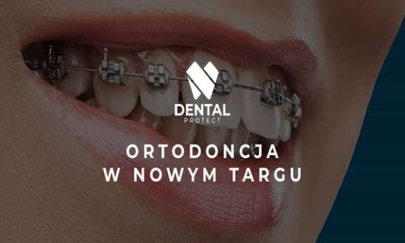 Ortodoncja, czyli korygowanie zgryzu