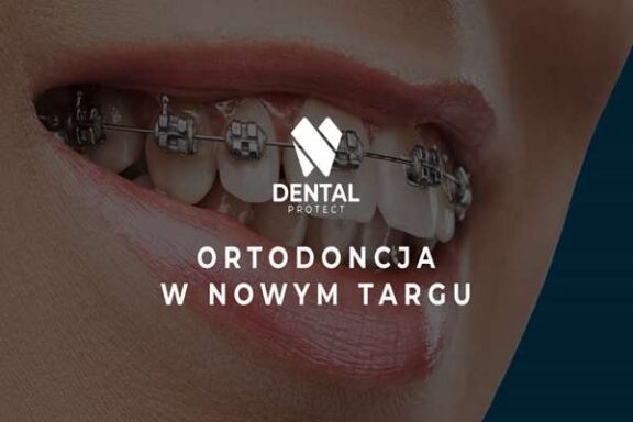 Ortodoncja, czyli korygowanie zgryzu
